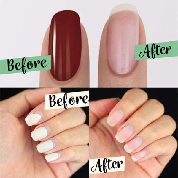 📢📢  1+1 gratis⏰✨ Nagellak verwijderen zonder gedoe – Verbeterde Magic Nagellakremover