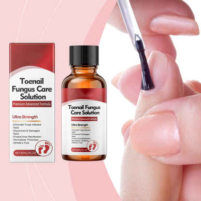 ✨ 50% KORTING – Nagelherstellende Essence, Versterkt, Herstelt & Beschermt Nagels Natuurlijk