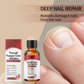 ✨ 50% KORTING – Nagelherstellende Essence, Versterkt, Herstelt & Beschermt Nagels Natuurlijk