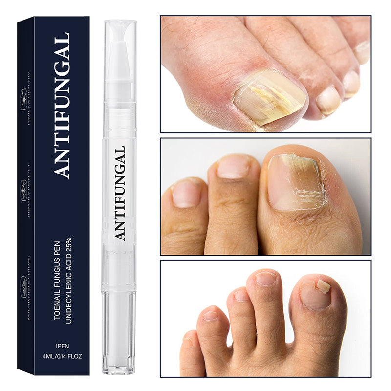 💅 Nagelherstelpen 2+1 GRATIS – herstel, versterk & hydrateer! 🎁✨