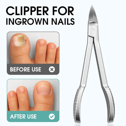 Nagelknipper met lang handvat en schuine rand voor ingegroeide nagels