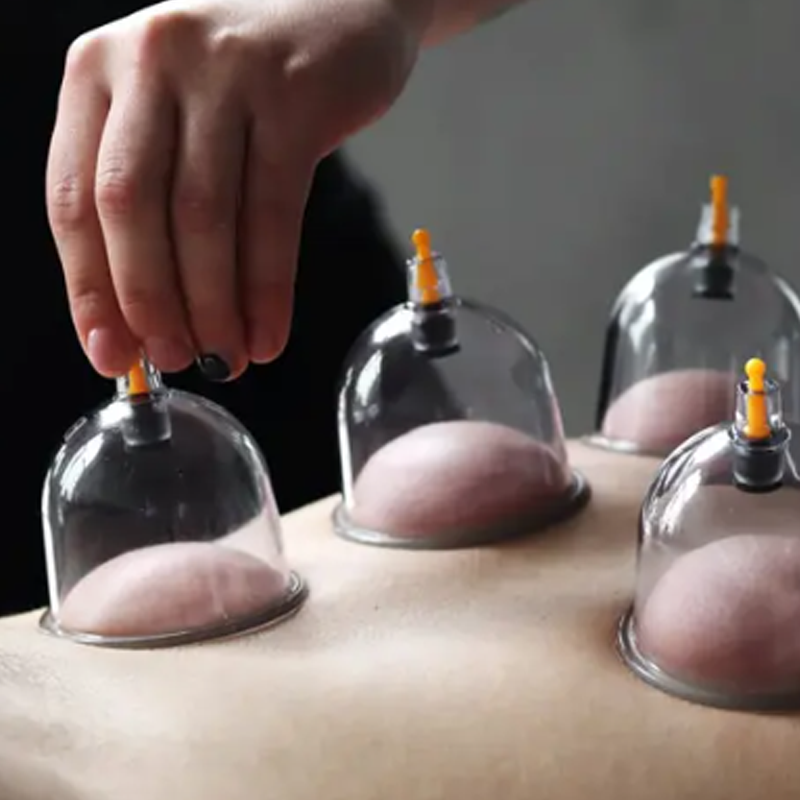 ⏳ Tijdelijke aanbieding⏰ Cuppingtherapie set met vacuümbekers – verdikt, met zuigpomp, transparant 🩺