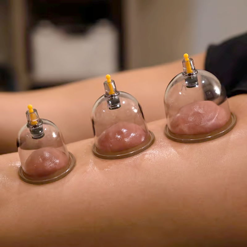 ⏳ Tijdelijke aanbieding⏰ Cuppingtherapie set met vacuümbekers – verdikt, met zuigpomp, transparant 🩺
